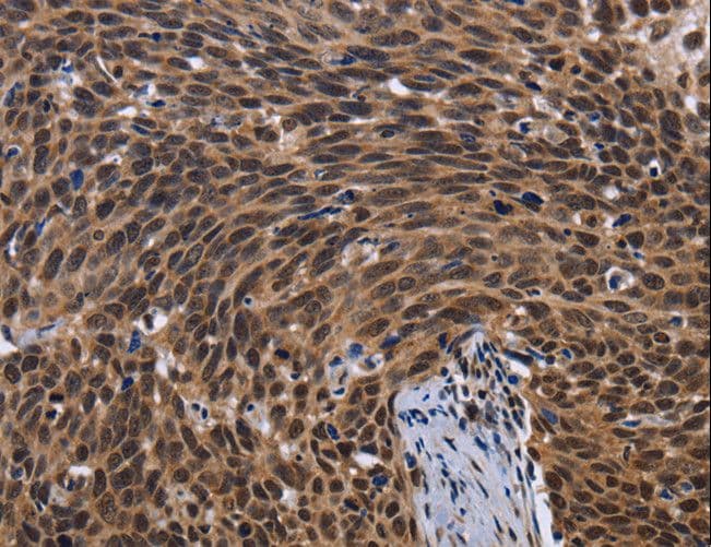 Polyclonal Rabbit anti-Human FASTKD5 Antibody (IHC)