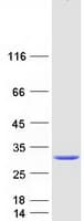 Human CRYBB2 Protein (Recombinant Myc-DDK (Flag))