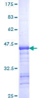 Human KIF11 / EG5 Protein (Recombinant GST, N-terminus)
