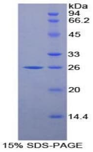 Mouse PSMB8 / LMP7 Protein (Recombinant His-T7)