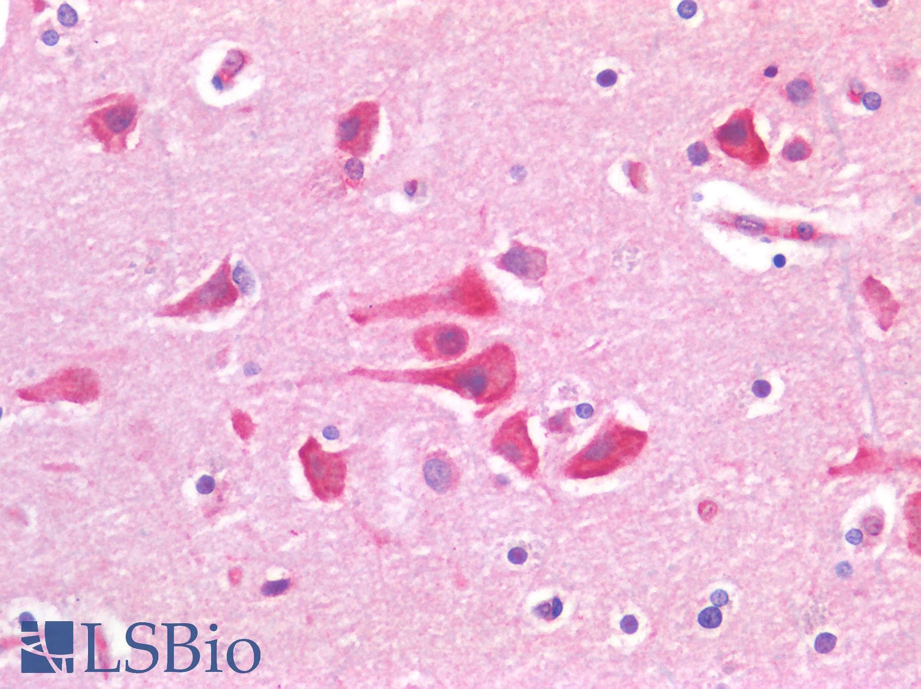 IHC-plus™ Polyclonal Rabbit anti-Human TP53 / p53 Antibody (IHC)
