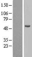 Human CYP21A2 Protein (Over-Expression Lysate Myc-DDK (Flag))