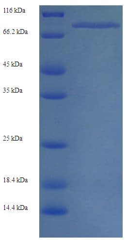 Human MYHC / MYH6 Protein (Recombinant His)