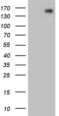 Monoclonal Mouse anti-Human CDH2 / N Cadherin Antibody (clone OTI1C5, Extracellular Domain, WB)
