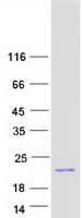 Human MDK / Midkine Protein (Recombinant Myc-DDK (Flag))