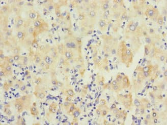 PTPN7 / HEPTP Antibody