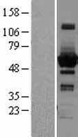 SCP2 / SCPX Protein (Over-Expression Lysate Myc-DDK (Flag))