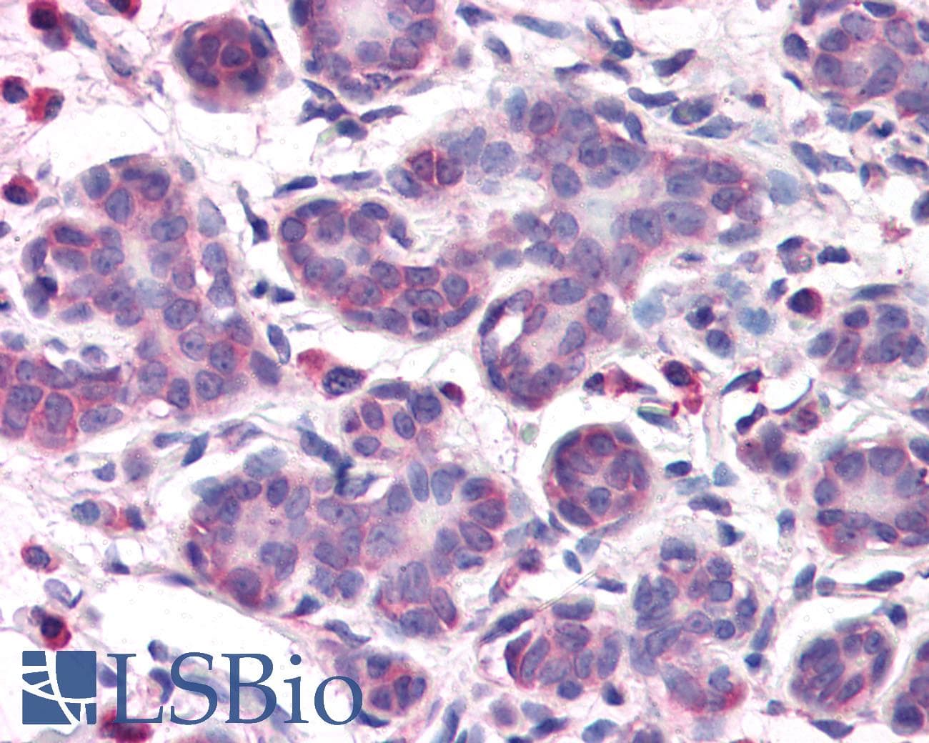IHC-plus™ OSTC Antibody (N-Terminus)