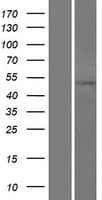 TMX3 Protein (Over-Expression Lysate Myc-DDK (Flag))