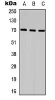 Polyclonal Rabbit anti-Human SPDL1 / CCDC99 Antibody (C-Terminus, WB)