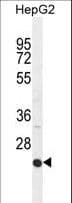 Polyclonal Rabbit anti-Human ICAM2 / CD102 Antibody (aa191-218, WB)