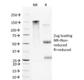 VCAM1 / CD106 Antibody (clone B-K9, Azide-free, BSA-free)