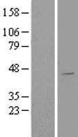 AGPAT5 Protein (Over-Expression Lysate Myc-DDK (Flag))