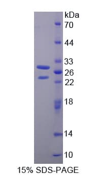 Human ETK / BMX Protein (Recombinant His-T7)