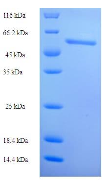Human TRXR1 / TXNRD1 Protein (Recombinant His-SUMO)