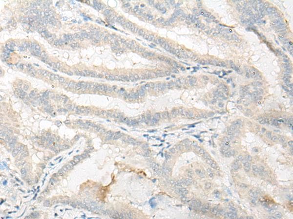 DNASE1L1 Antibody