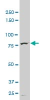 TTF2 / HuF2 Antibody (clone 3D11)