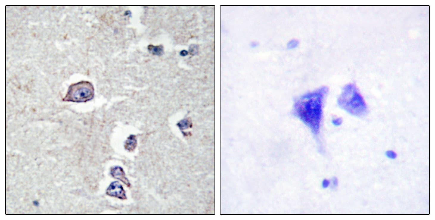PDGFRA / PDGFR Alpha Antibody (aa721-770)
