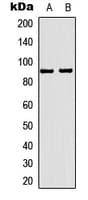 PR / Progesterone Receptor Antibody (Internal)