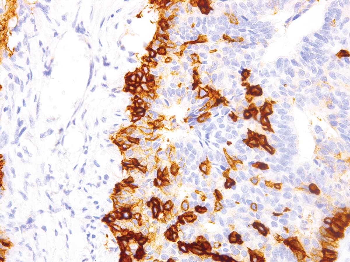 NGFR / CD271 / TNR16 Antibody (Concentrated)