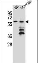 PRAMEF12 Antibody (aa107-135)