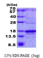 Human CD247 / CD3 Zeta Protein (Recombinant His)
