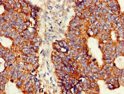 ASNS Antibody