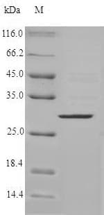 Human CMA1 / Mast Cell Chymase Protein (Recombinant 6His, N-terminus)