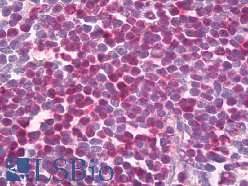 IHC-plus™ Polyclonal Rabbit anti-Human PARP1 Antibody (aa1-1014, IHC, WB)