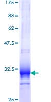 Human UCP1 / UCP-1 Protein (Recombinant GST, N-terminus)
