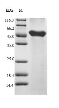 Mouse VRK1 Protein (Recombinant 6His, N-terminus + Myc, C-terminus)