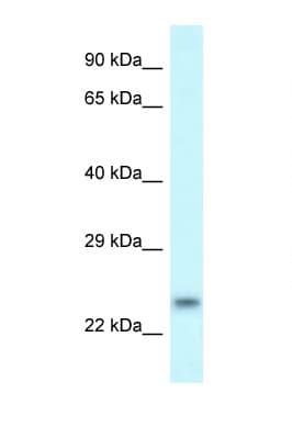 RND1 Antibody (C-Terminus)