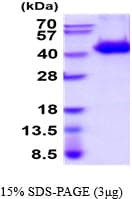Human WIF1 Protein (Recombinant His)