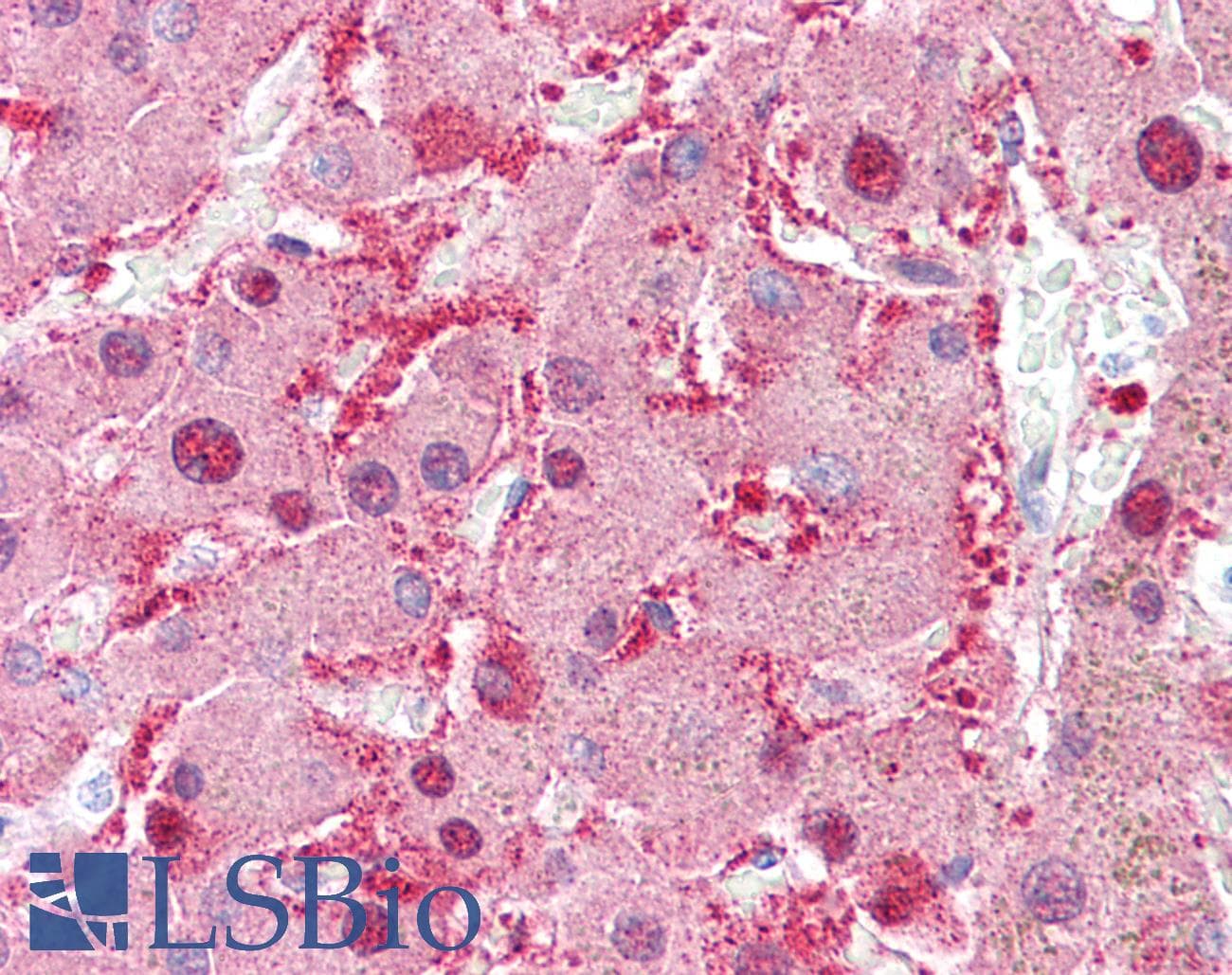 IHC-plus™ DDH / AKR1C1 Antibody (clone AT6D10)