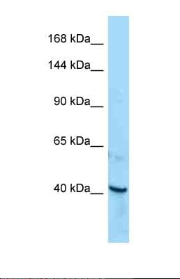 Polyclonal Rabbit anti-Human ROR1 Antibody (aa838-887, WB)