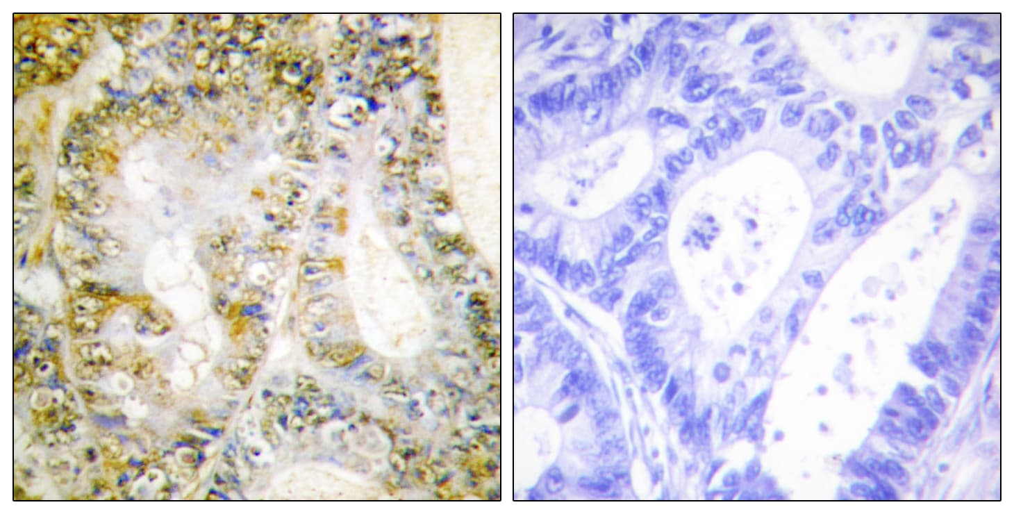 CTNNB1 / Beta Catenin Antibody (aa626-675)