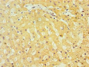 TBRG1 Antibody (aa22-150)