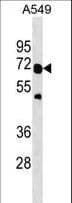 Polyclonal Rabbit anti-Human TRAF6 Antibody (aa314-343, WB)