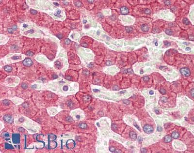 IHC-plus™ Polyclonal Rabbit anti-Human SUSD1 Antibody (IHC, WB)