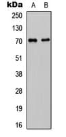 Polyclonal Rabbit anti-Human CDC25A Antibody (Internal, WB)