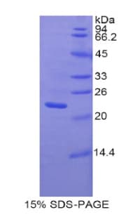 Rat PANX1 / Pannexin 1 Protein (Recombinant His)
