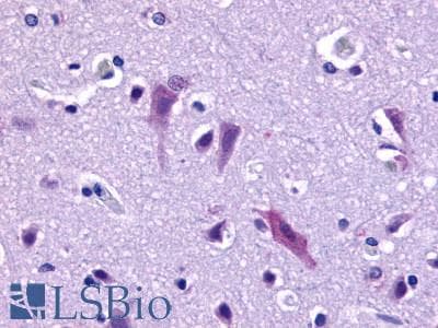 PathPlus™ Polyclonal Rabbit anti-Human QRFPR / GPR103 Antibody (Cytoplasmic Domain, IHC)