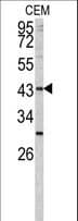 FUT1 / HSC Antibody (aa164-195)