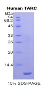 Human CCL17 / TARC Protein (Recombinant His)