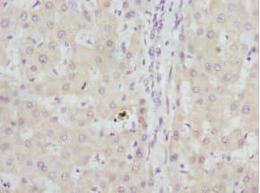 GBE1 Antibody