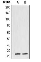 TPT1 / TCTP Antibody (Internal)