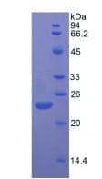 Rat FGF13 Protein (Recombinant His, N-Terminal)