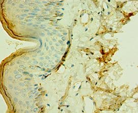 TCTN2 Antibody (aa420-670)