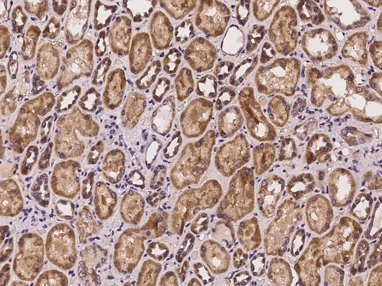 Polyclonal Rabbit anti-Human COX11 Antibody (IHC)