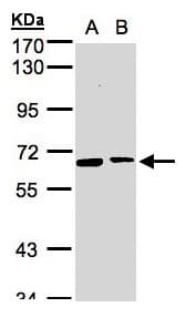 SENP2 Antibody (aa1-62)